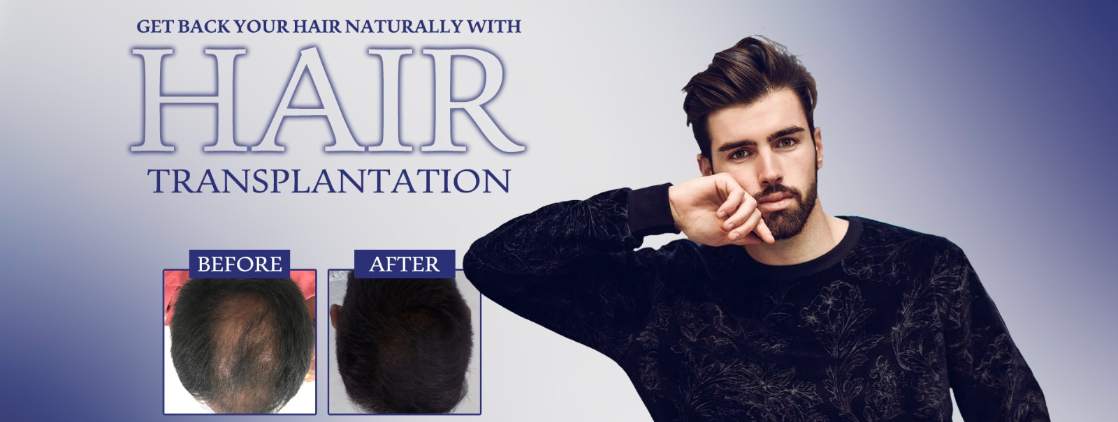 Hair Transplantation in Vizag