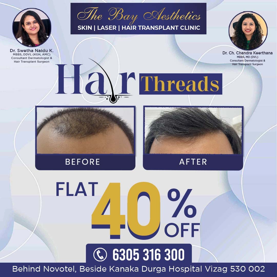 Hair Transplantation in Vizag