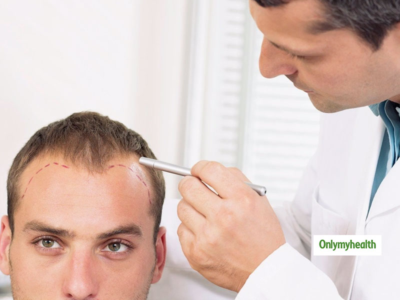 Hair loss treatment in Vizag