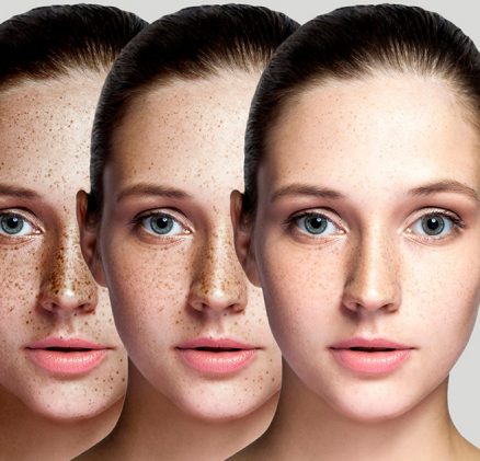 Effective Skincare Tips for Dry Skin: A Dermatologist’s Guide