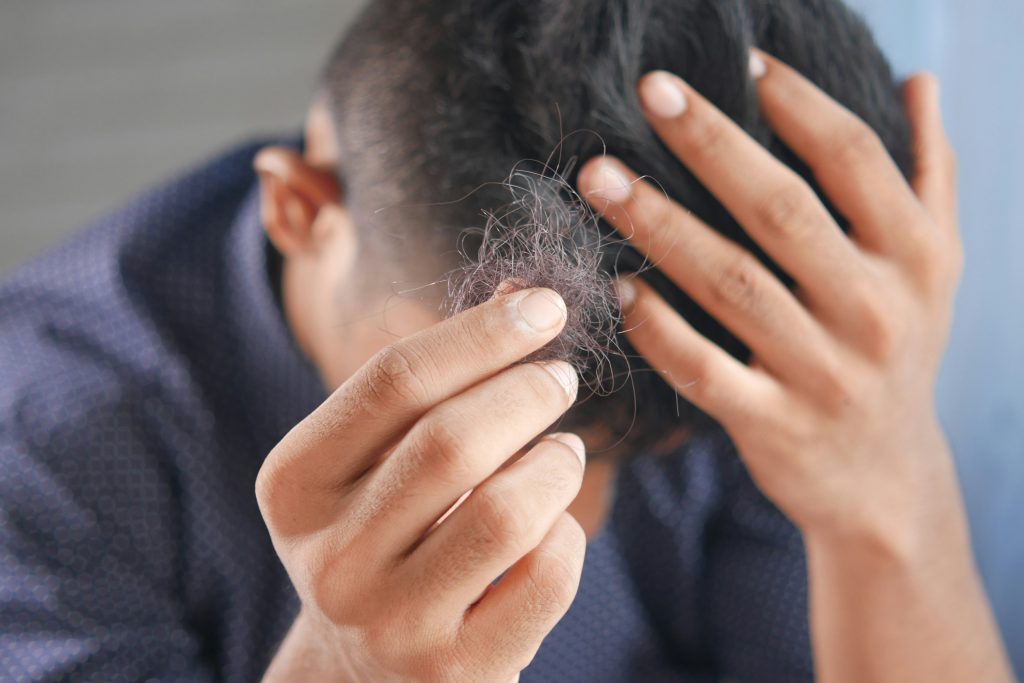 Hair loss treatment in Vizag